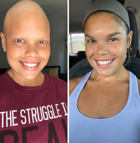 Jessica Beniquez Battle with Cancer