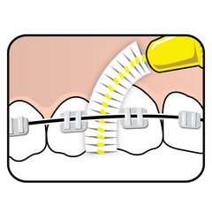 Cepillo Interdental TePe para ortodoncia