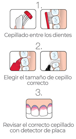 Periodontitis cepillado - CCS dental