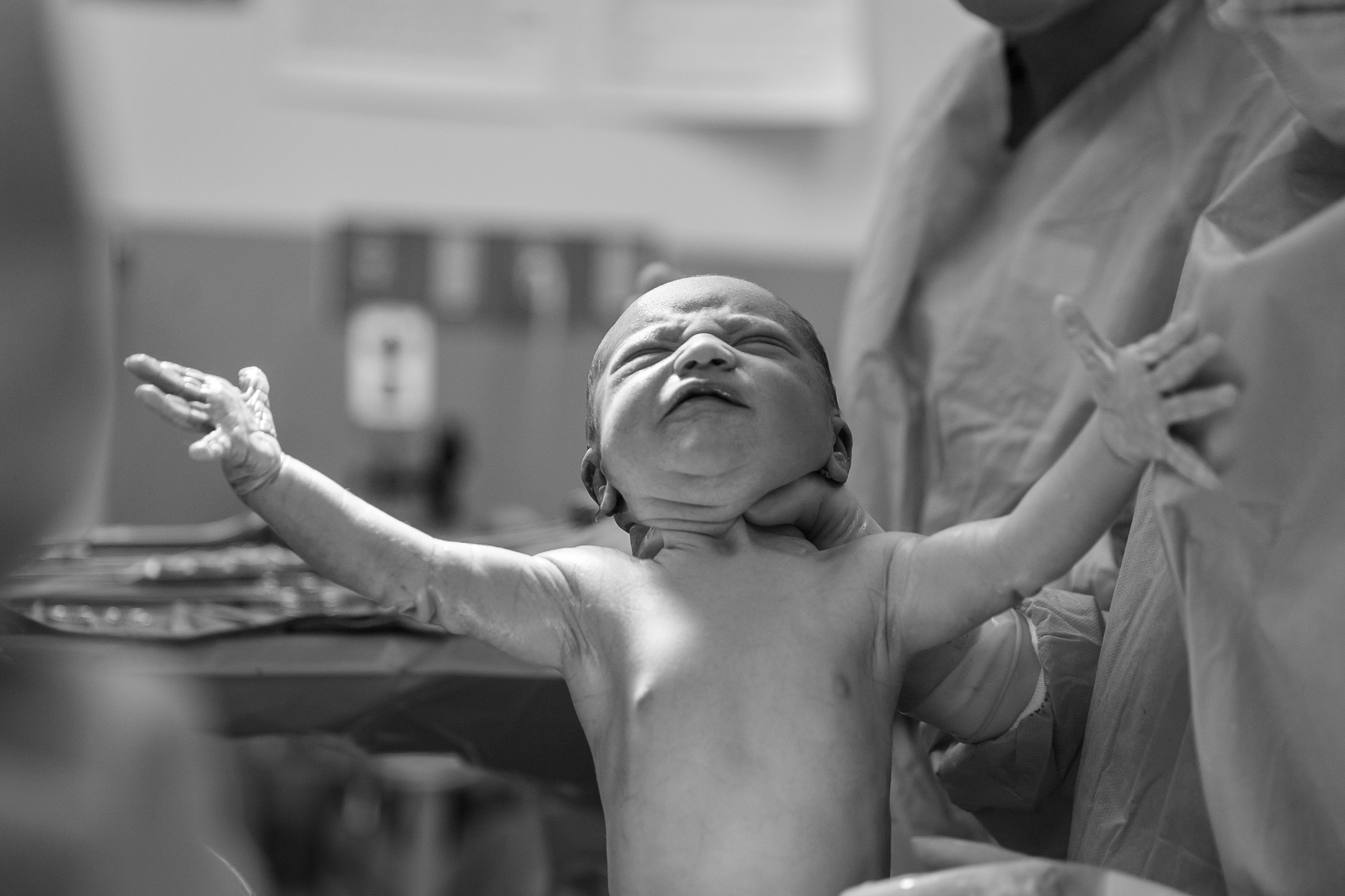 Black and white photo of a newborn baby right after birth