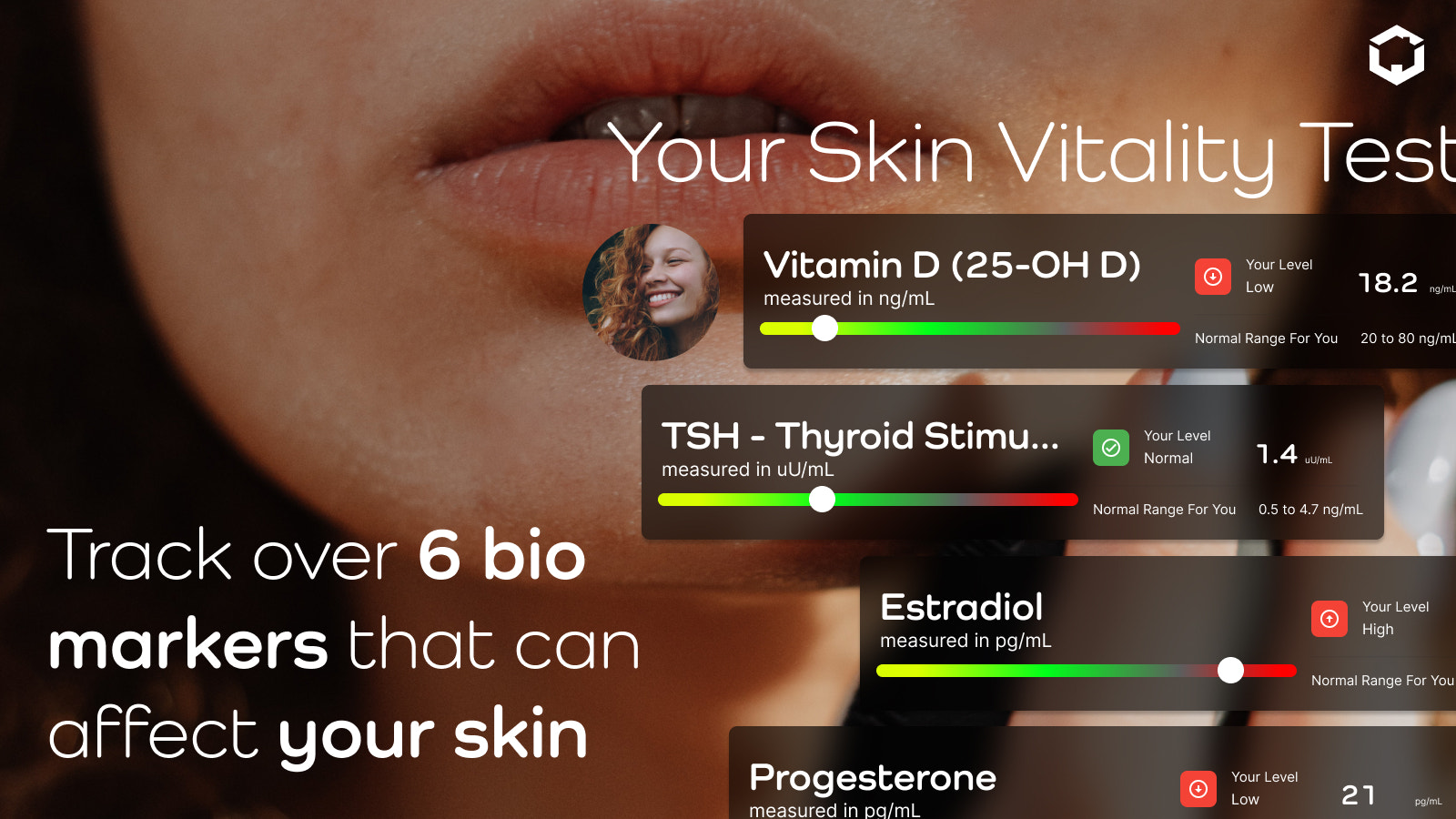 Skin Test Example