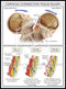 Image 12986: Cervical Connective Tissue Injury Illustration