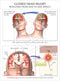 Image 20897: Closed Head Injury Illustration