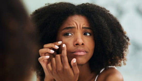 les causes de l acne sur Peau noire 