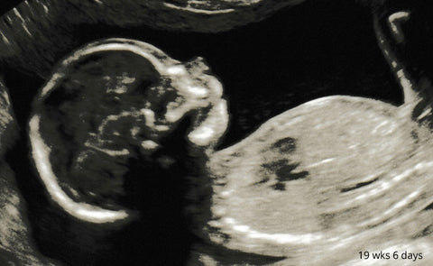 19wks-ultrasound
