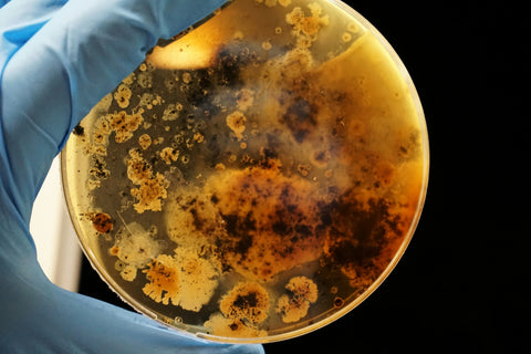 Petri dish full of bacteria