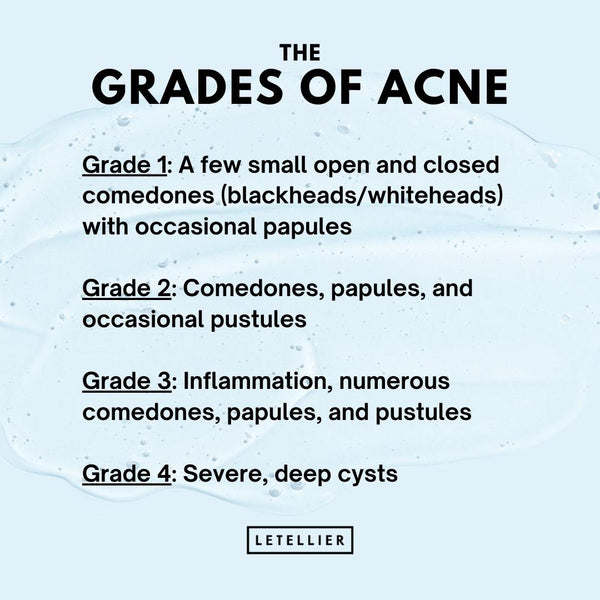 les degrés d'acné