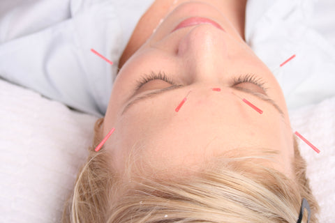 Facial Acupuncture Training