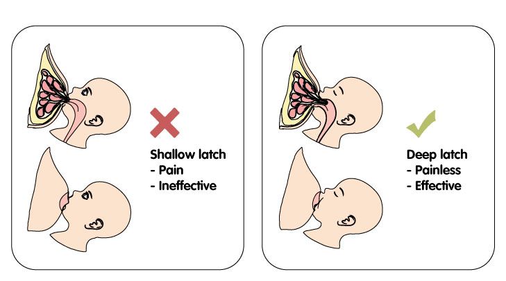 How To Avoid Breastfeeding Problems - Latch It Right