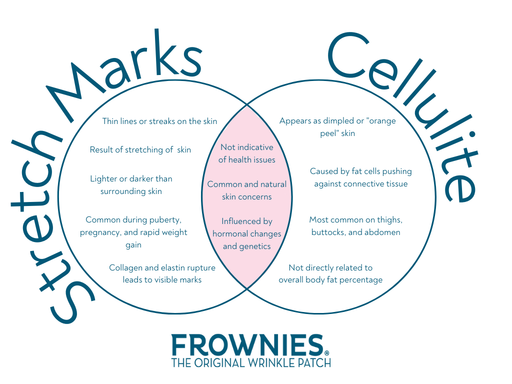 details on the similarities and differences of stretch marks and cellulite
