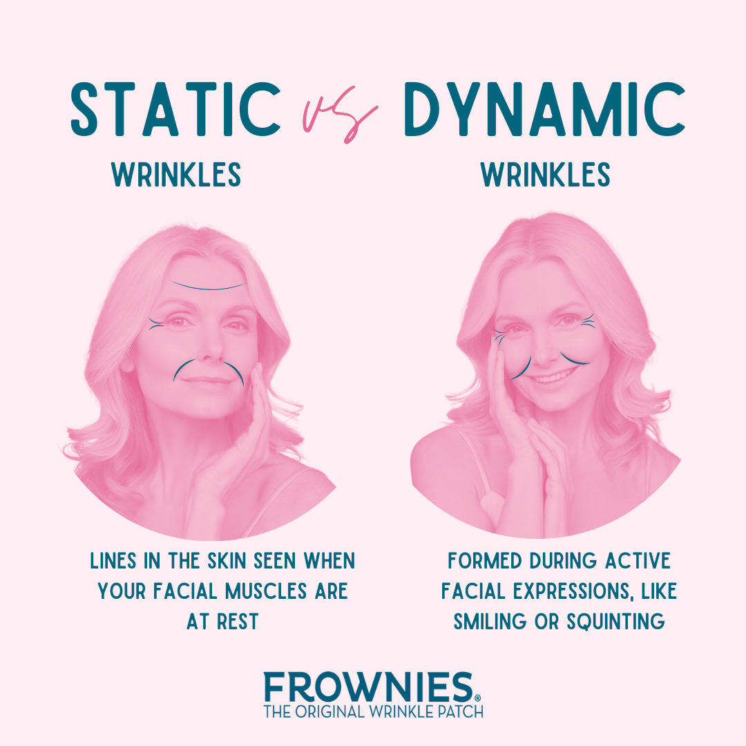 static wrinkles vs dynamic wrinkles infographic