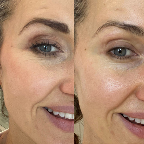 side by side of half of woman's face to show progression of crows feet wrinkles around the eyes