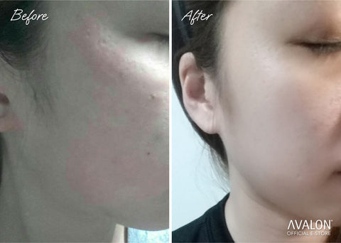 Results Avalon Stemcell Beauty Drink Collagen