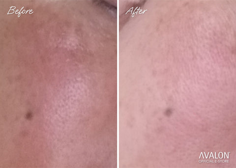 Results Avalon Stemcell Beauty Drink Collagen