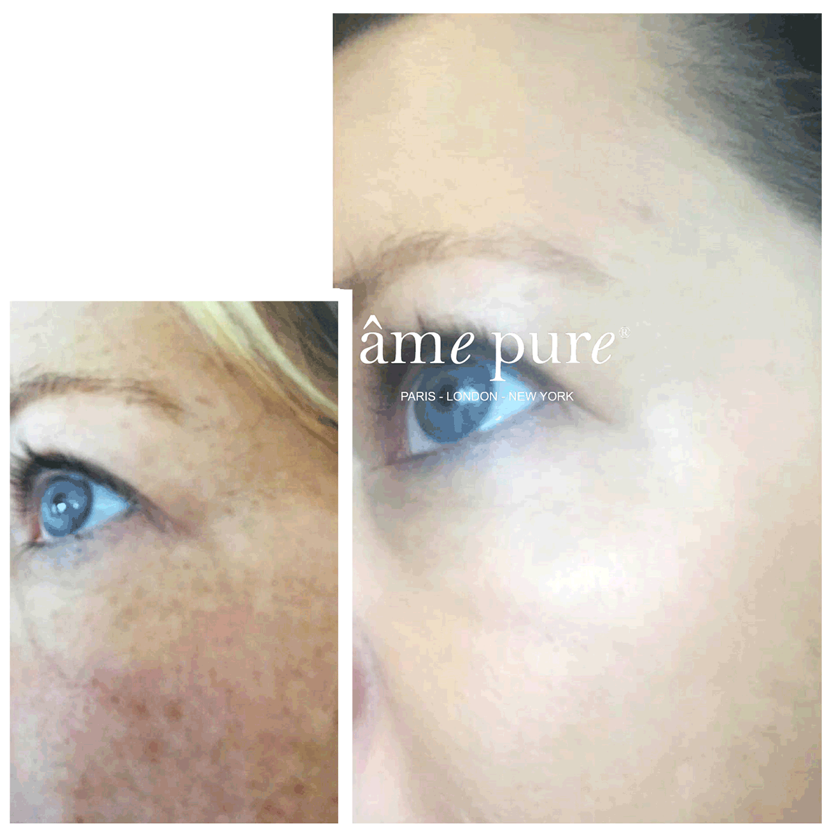 Donna Before After Ame pure Treatment