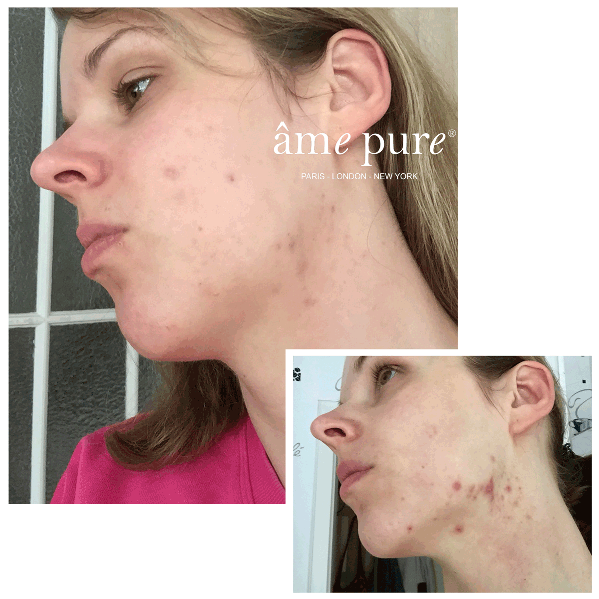 Jeaninne before after Ame pure