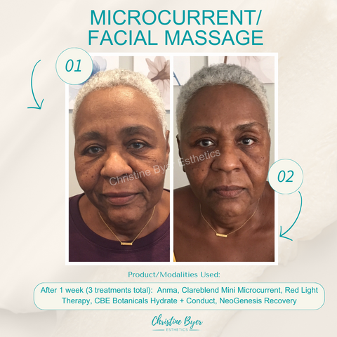 Microcurrent results