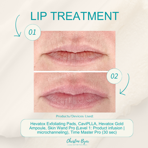 lip Treatment