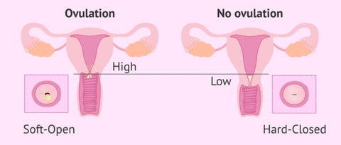 Uterine or cervical abnormalities
