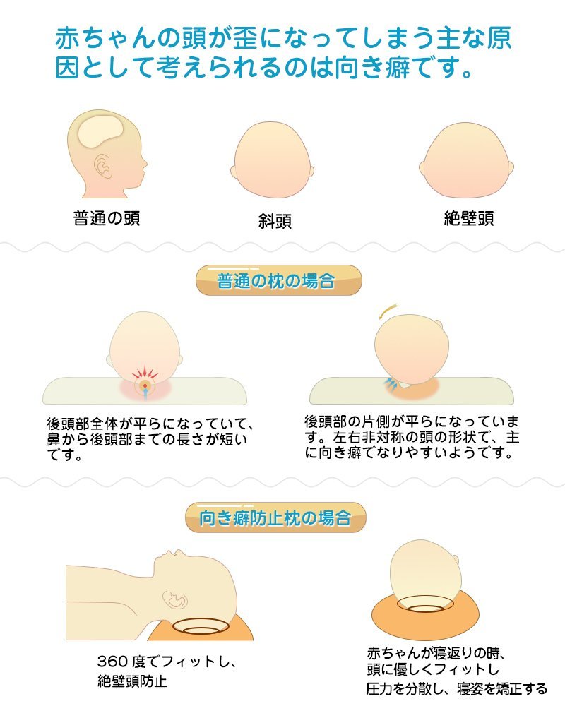 Adokoo ベビーまくら 向き癖防止枕 赤ちゃん枕 絶壁頭 斜頭 頭の形整える 寝姿矯正 Ikstar