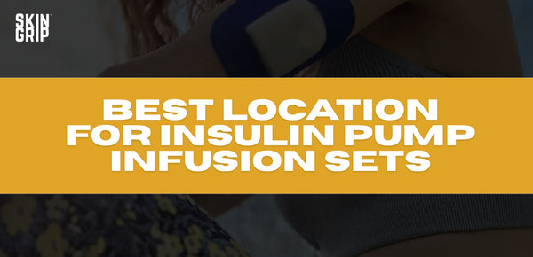 best location for insulin pump infusion sets banner image