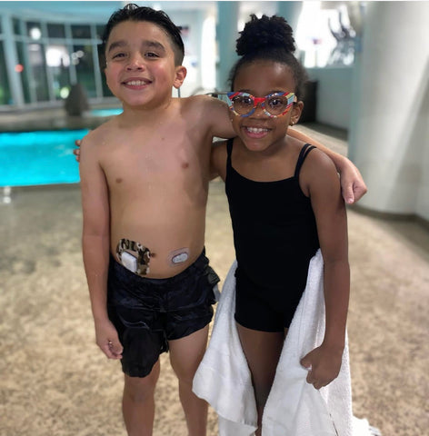 Image of two children, one wearing an insulin pump and cgm