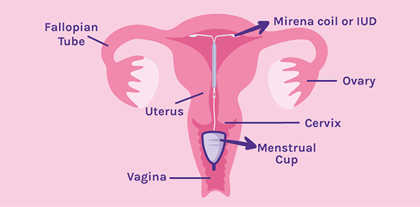 Can I use a menstrual cup if I have a Mirena coil or IUD fitted?