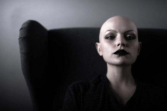 Photo for article: who is a cancer survivor? Bald woman stares defiantly at camera while seated.