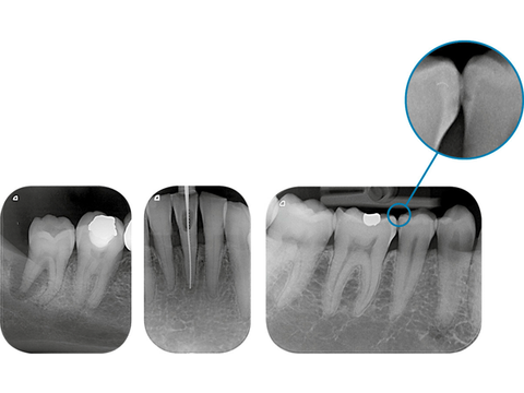 dental imaging - VistaScan MIni Plus