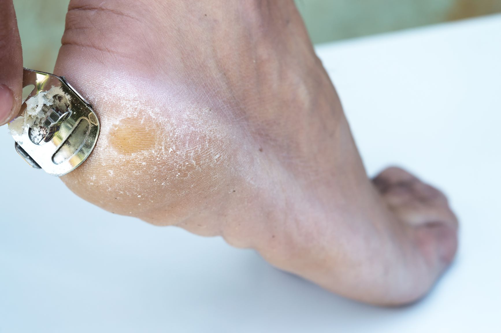 Electric Foot Callus Dead Skin Remover Scraper Foot Care Tool – Prime Stash