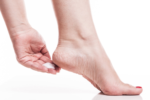 foot care tips cracked heels