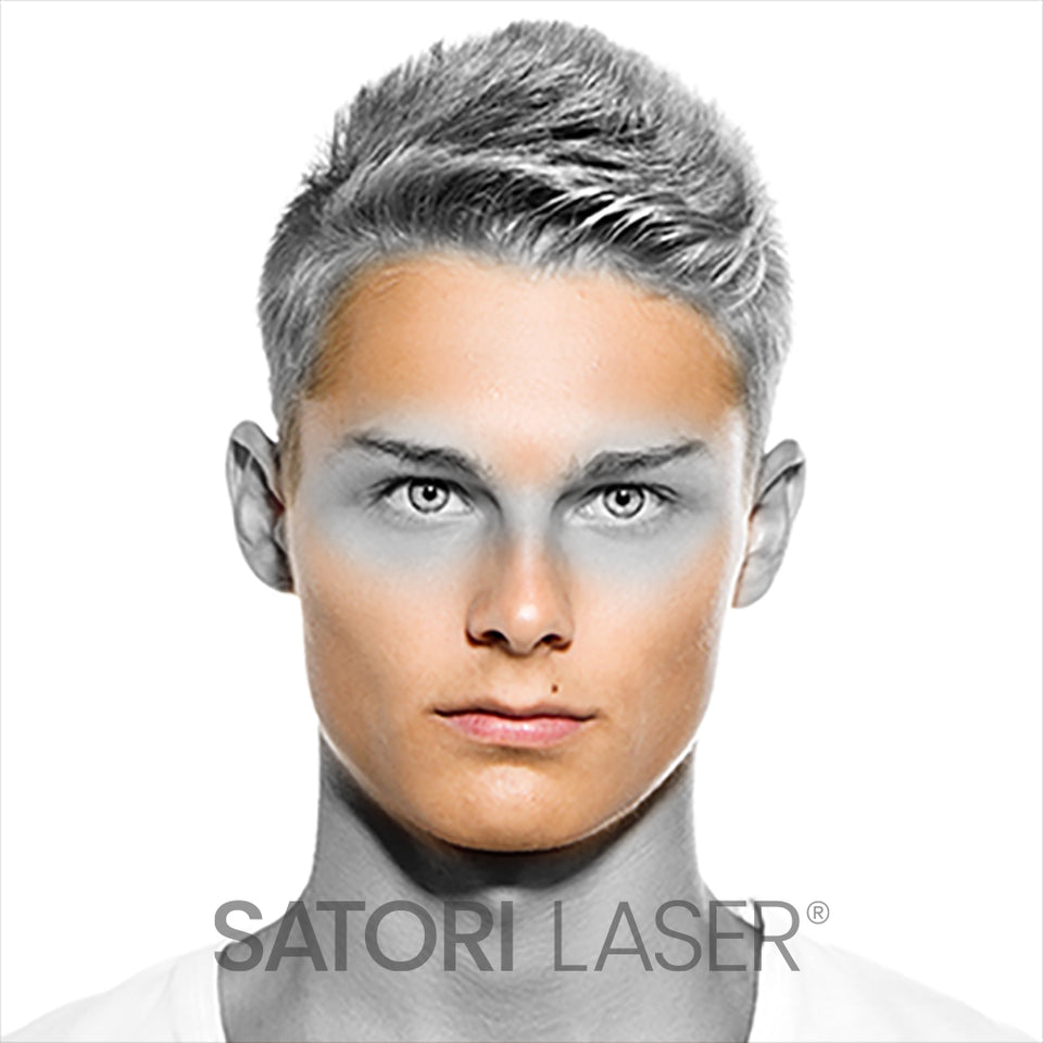 Face (M) Laser Hair Removal – Satori Laser