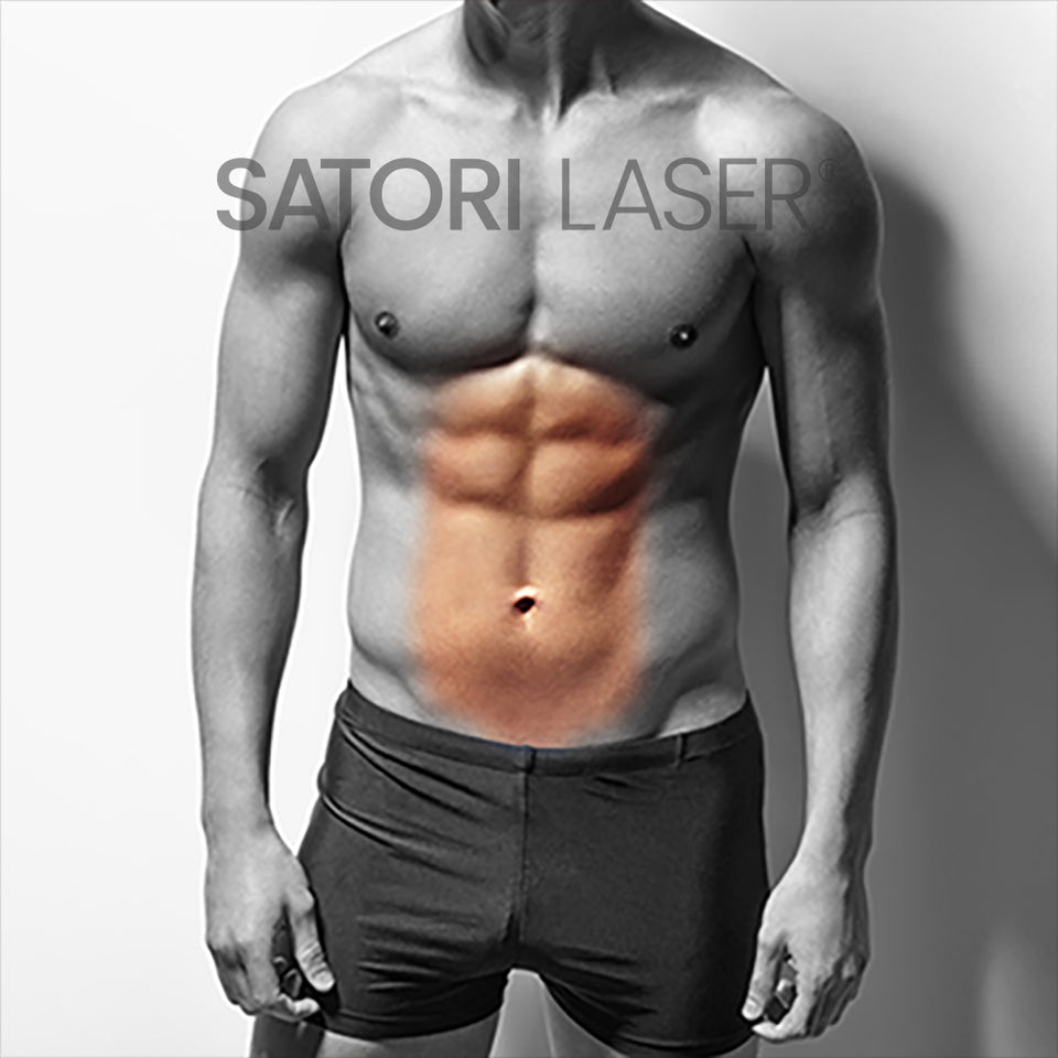 satori laser