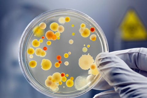 cultured bacteria in a petri dish