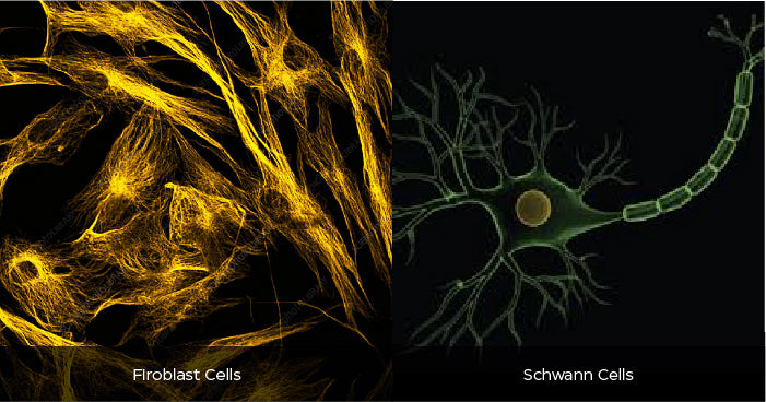 Types of nerve cells
