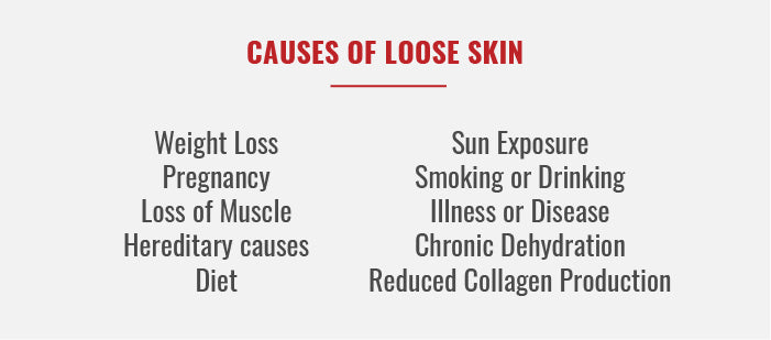 Causes of Loose Skin