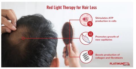 Red Light Therapy for Hair Loss: Does it Really Work?