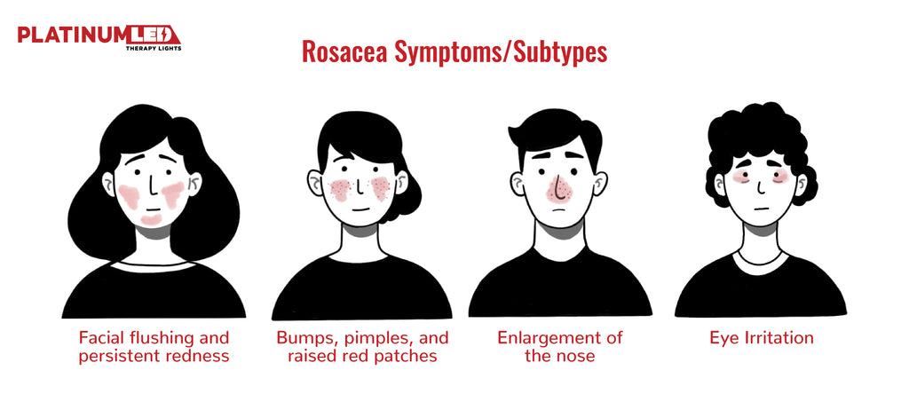 The Impact of Rosacea