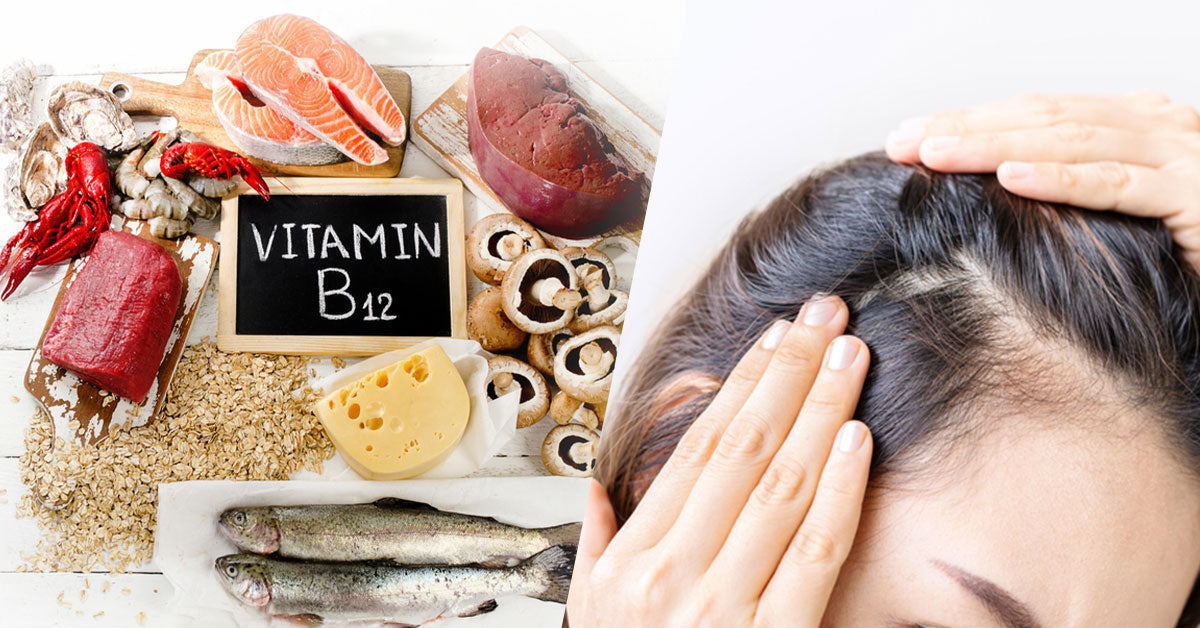 Which vitamin deficiency causes hair loss All about B12 Vitamin D