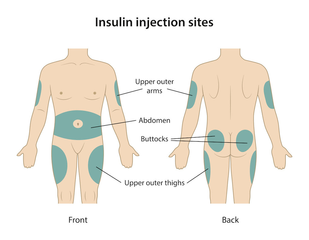 Best insulin injection sites