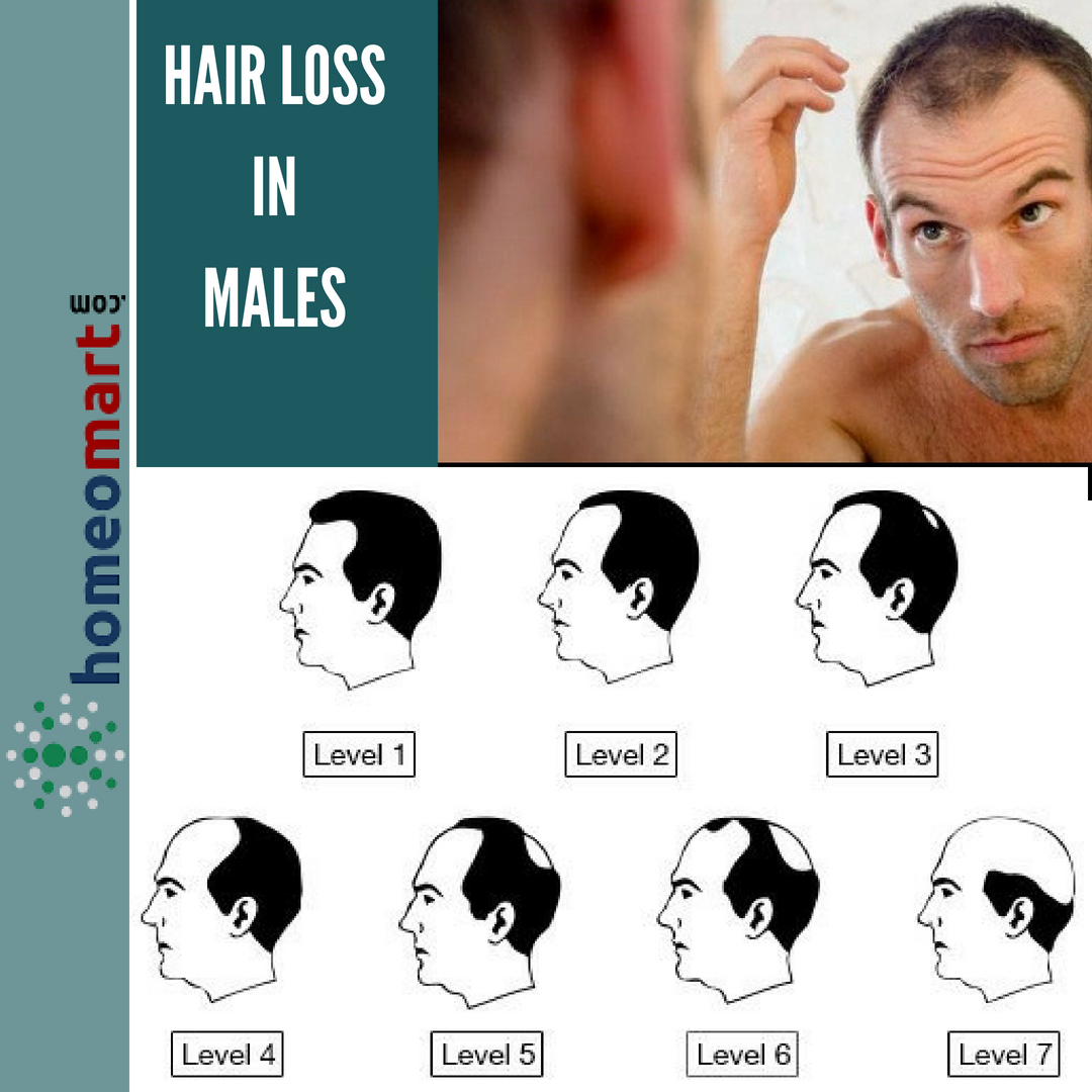20 Best Homeopathic Medicines For Hair Loss And Regrowth