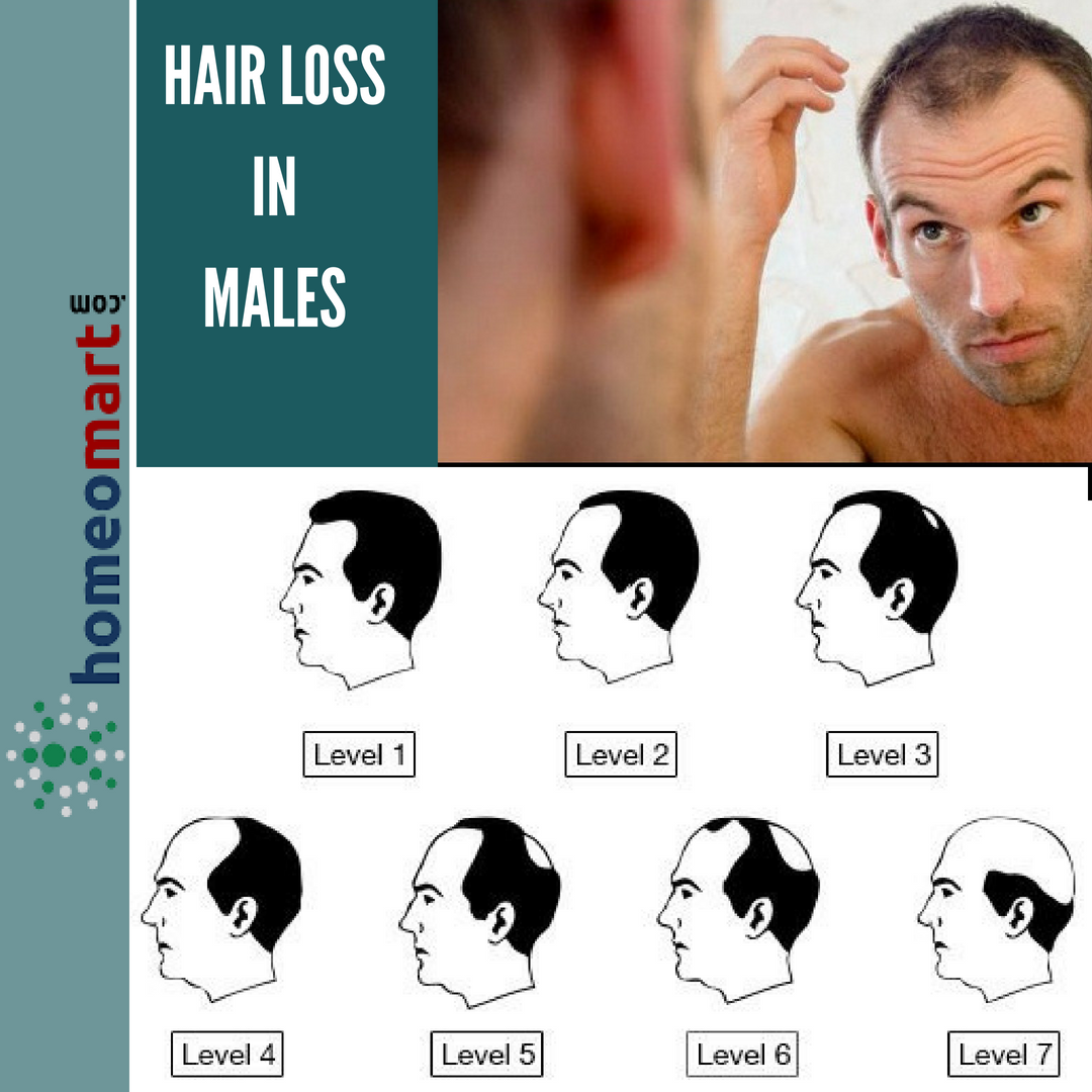 Top 20 effective ways to stop hair fall in men  Dr Batras