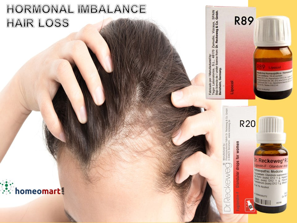 Best homeopathy medicines for hair loss grey hair dandruff online  Page  3  Homeomart