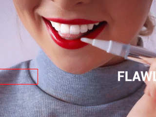 #1 Teeth Whitening Pen - Perfect Smile â Trend Delivery