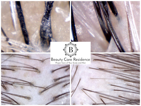 Residue on the Scalp Treatment Before & After | Beauty Care Residence
