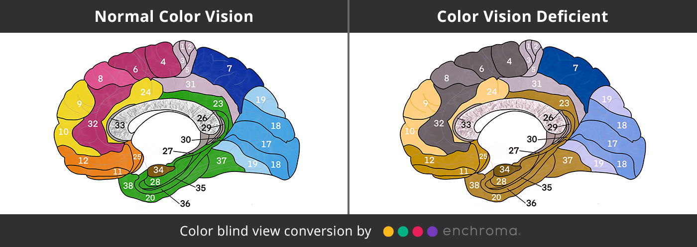 Human Brain Color Blind View vs. Normal View