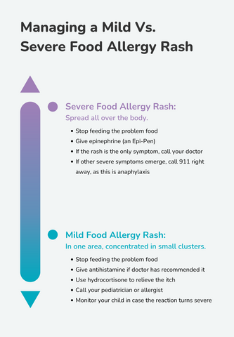 how to manage a mild v. severe food allergy rash