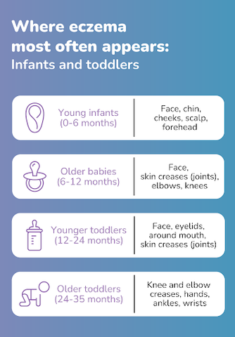 Where eczema most often appears- Infants and toddlers
