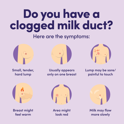 Clogged Milk Duct: Symptoms and Treatment