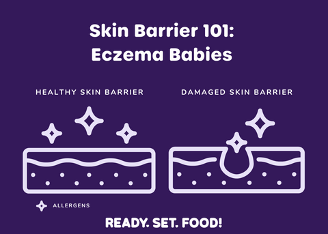 Skin Barrier 101 for Eczema Babies: Examples of Healthy and Damaged Skin Barriers